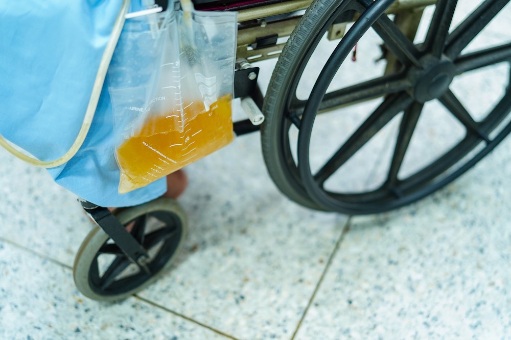 Les partenariats stratégiques dans l'industrie des poches urinaires